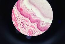 neurological-breakdown-explained:-the-brain-damage-that-makes-ozdikenosis-fatal